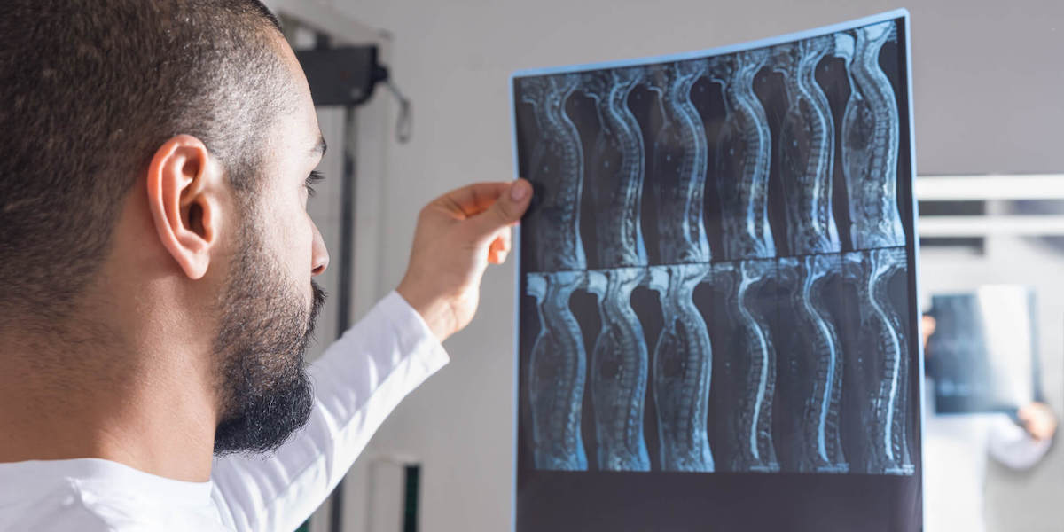 Spinal Cord xray